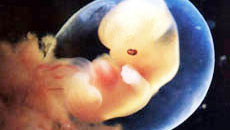 1-3 месяц беременности