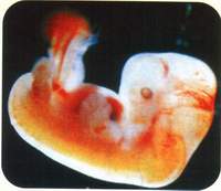 Третий месяц беременности