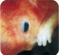 Пятый месяц беременности