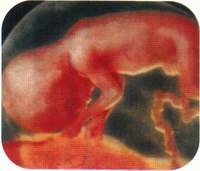 Седьмой месяц беременности