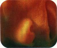 Восьмой месяц беременности