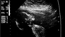 Развитие человеческого зародыша