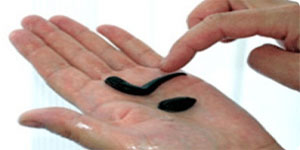 Гирудотерапия